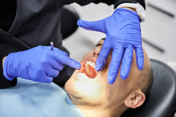Best Emergency Dentist for Lost Fillings or Crowns in Hart, TX